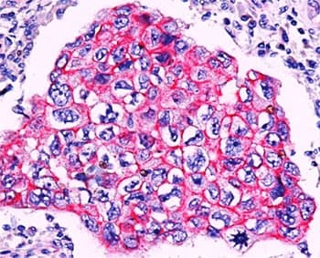CTNNB1 / Beta Catenin Antibody