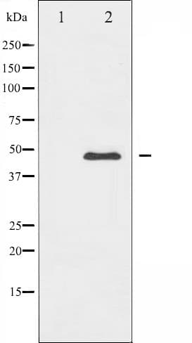 Polyclonal Rabbit anti-Human PTP1B Antibody (IHC, IF, WB)