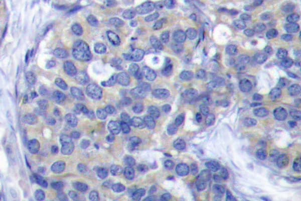 Polyclonal Rabbit anti-Human ZAP70 Antibody (Ser313, IHC, IF, WB)