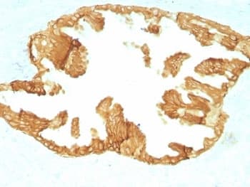 Basic Cytokeratin Antibody (clone KRTH/1076)