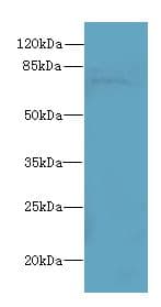 SORBS3 / Vinexin Antibody