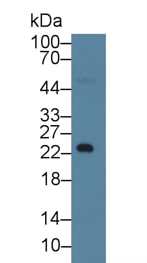 NPHS1 / Nephrin Antibody