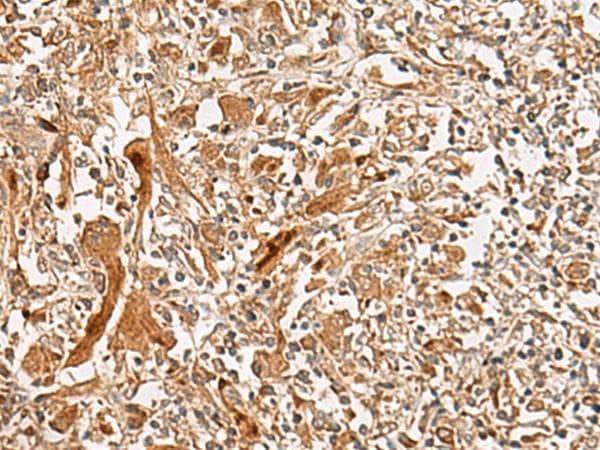 GCC2 Antibody