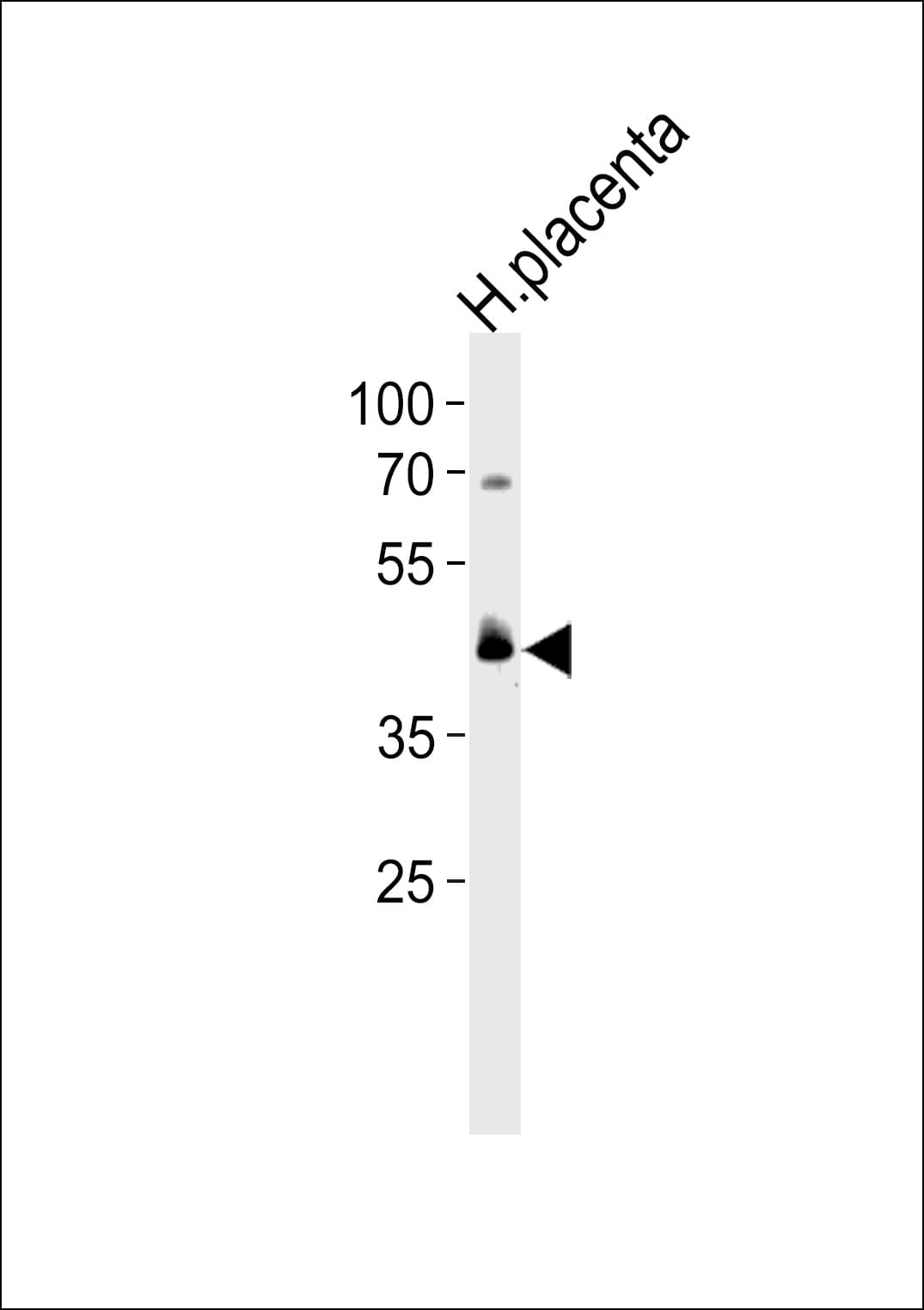 Polyclonal Rabbit anti-Human PPARD / PPAR Delta Antibody (aa364-393, WB)