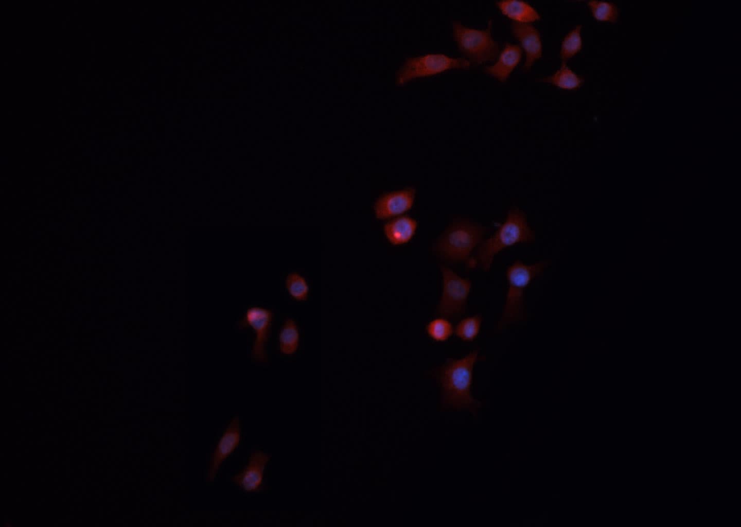 XRCC6 / Ku70 Antibody