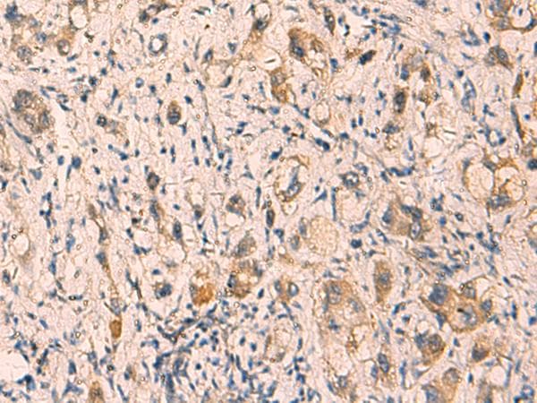 CRYM Antibody