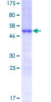 Human HOXC6 Protein (Recombinant GST)