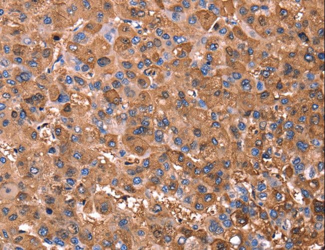 ERN2 Antibody