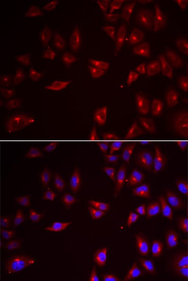 PRAME Antibody (aa1-300)