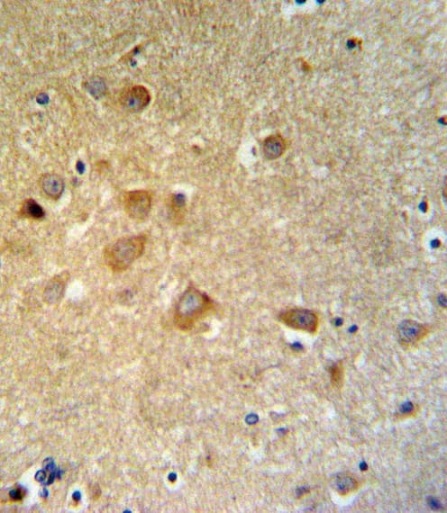 GTSE1 Antibody (aa690-717)