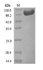 Human F2 / Prothrombin / Thrombin Protein (Recombinant 6His, N-terminus)