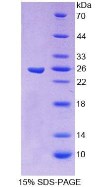Human CBFB Protein (Recombinant His-T7)