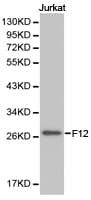 Polyclonal Rabbit anti-Human F12 / Factor XII Antibody (IHC, WB)