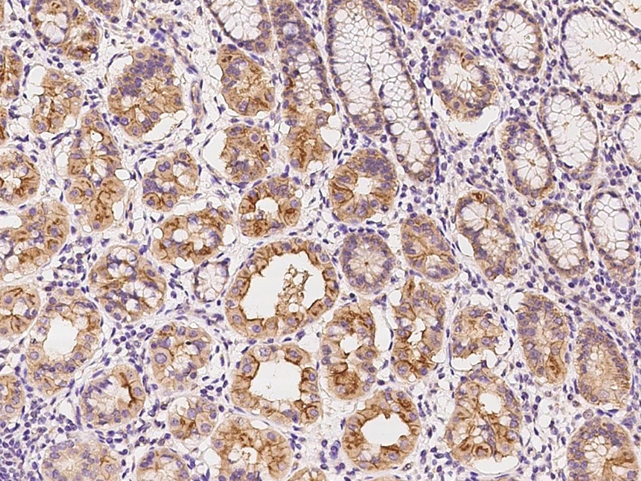 Polyclonal Rabbit anti-Human SLC44A3 Antibody (IHC)