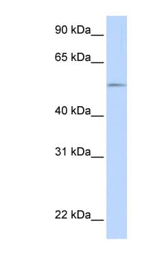 UGT1A / UGT1A1 Antibody (aa36-85)