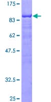 Human LCP2 / SLP-76 Protein (Recombinant GST)