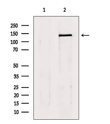 LATS1 Antibody