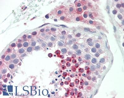IHC-plus™ AP2A1 / AP2-Alpha Antibody (aa1-260)