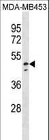IHC-plus™ Polyclonal Rabbit anti-Human NDUFV1 Antibody (aa21-50, IHC, WB)