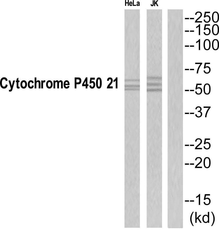 CYP21 / Steroid 21-Hydroxylase Antibody