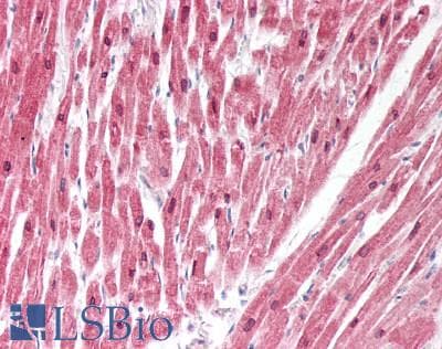 TP53INP2 Antibody