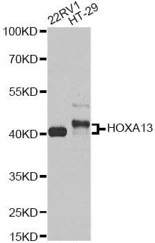 Polyclonal Rabbit anti-Human HOXA13 Antibody (WB)