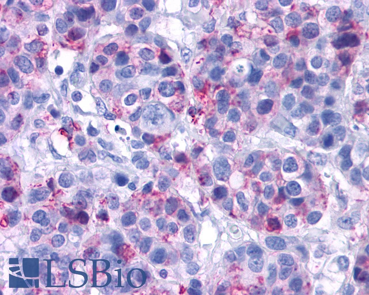 PathPlus™ Polyclonal Rabbit anti-Human VPAC2 / VIPR2 Antibody (C-Terminus, IHC)