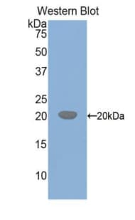 CSF1R / CD115 / FMS Antibody (aa768-928)