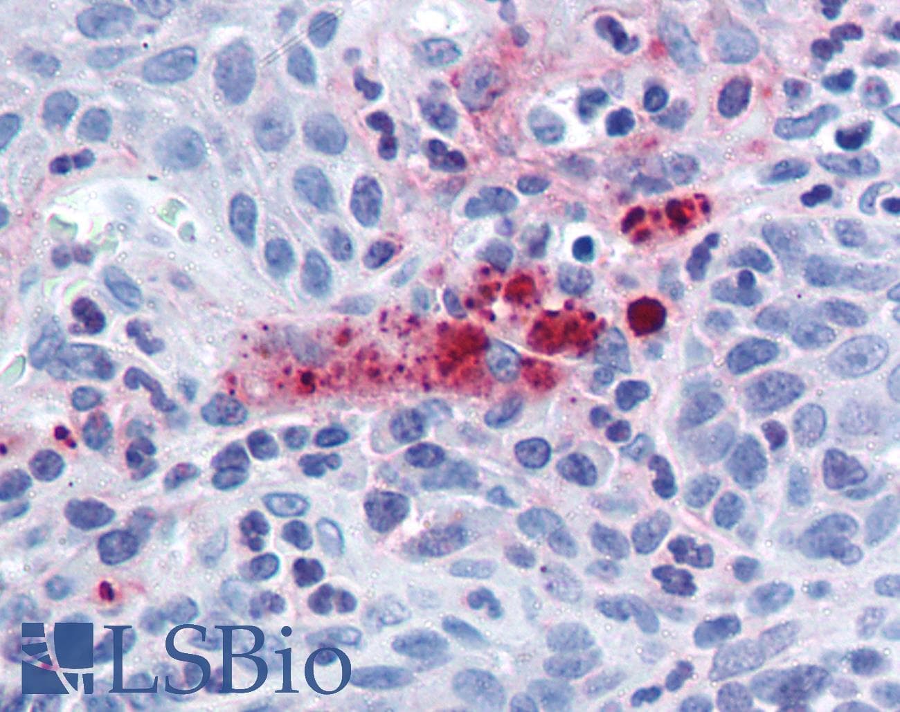 IHC-plus™ ACIN1 / Acinus Antibody (C-Terminus)