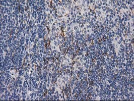 DES / Desmin Antibody (aa104-391, clone 4G1, Carrier-free)