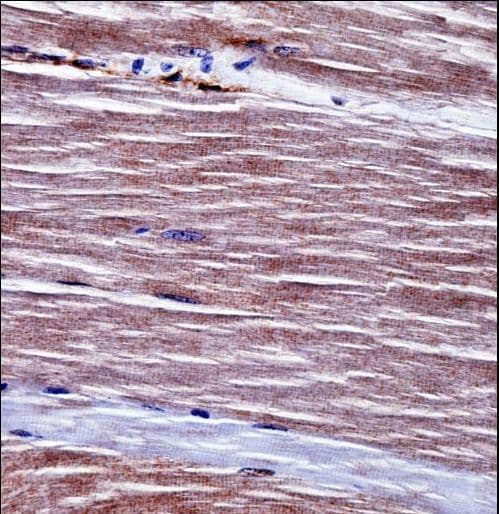 ALK2 / ACVR1 Antibody (aa137-166)