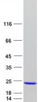 Human NUDT1 / MTH1 Protein (Recombinant Myc-DDK (Flag))
