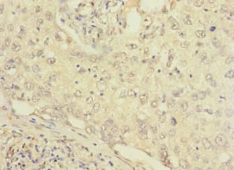 FCRL2 / IRTA4 Antibody