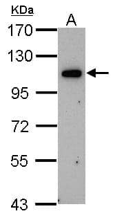 OSBPL6 Antibody (aa872-934)