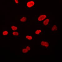 Polyclonal Rabbit anti-Human VWA5A Antibody (Internal, IF, WB)