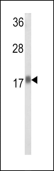 RPL31 / Ribosomal Protein L31 Antibody (aa24-51)