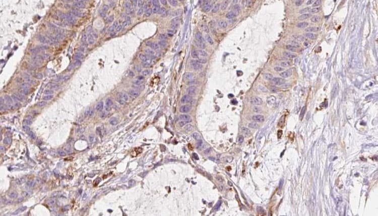 ETFB Antibody