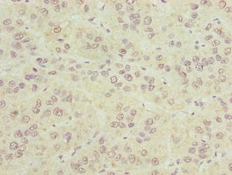 CIPC / KIAA1737 Antibody