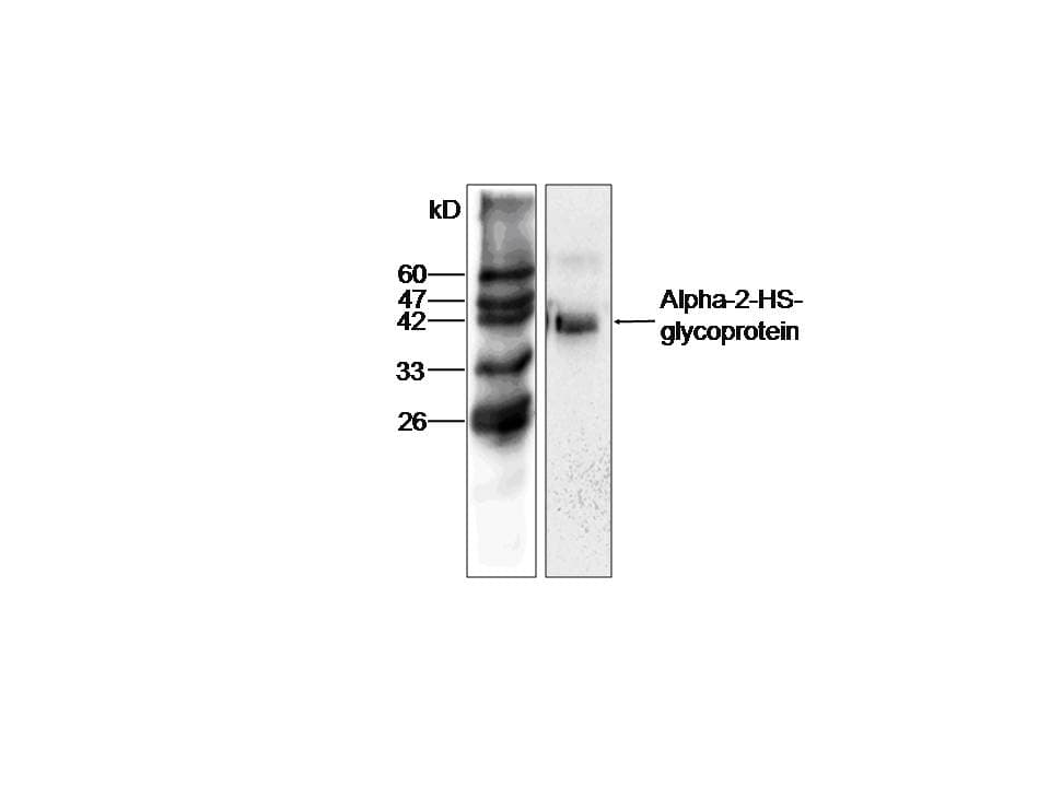 AHSG / Fetuin A Antibody (aa19-367)