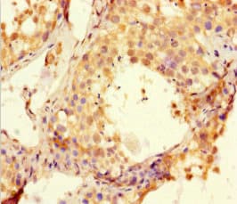HSBLMHC1 / BTNL2 Antibody