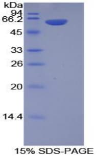 Mouse ITGA9 / Integrin Alpha 9 Protein (Recombinant His-GST)