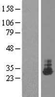 Human THTPA Protein (Over-Expression Lysate Myc-DDK (Flag))