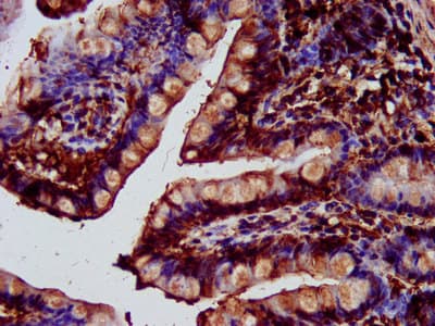 Polyclonal Rabbit anti-Human SAT2 Antibody (IHC, IF)