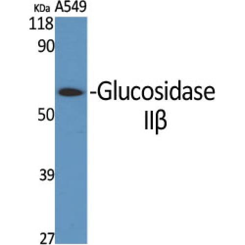 PRKCSH Antibody (50-130 aa, Internal)