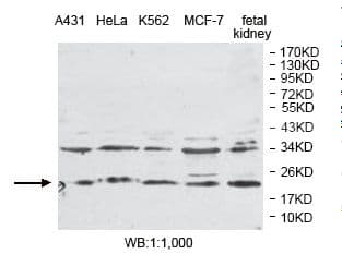 Polyclonal Rabbit anti-Human PLDN / Pallidin Antibody (aa1-172, IHC, WB)