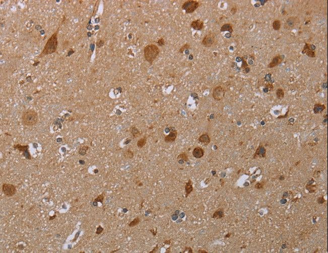 Polyclonal Rabbit anti-Human MARK1 / MARK Antibody (IHC)