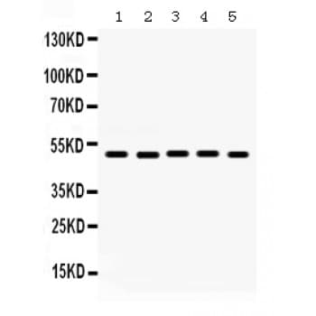 LGALS8 / Galectin 8 Antibody (aa286-317)