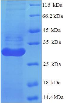 Human LILRA5 Protein (Recombinant His)