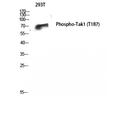 MAP3K7 / TAK1 Antibody (130-210 aa)