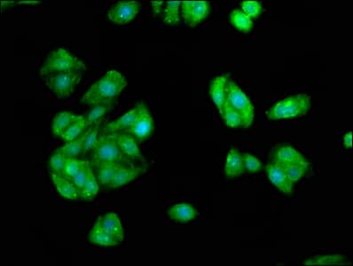 Polyclonal Rabbit anti-Human IST1 Antibody (IHC, IF)